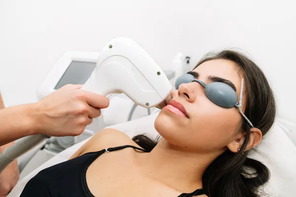 IPL (Intense Pulsed Light)