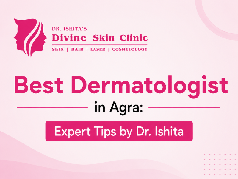 How to Choose the Best Dermatologist in Agra: Expert Tips from Dr. Ishita