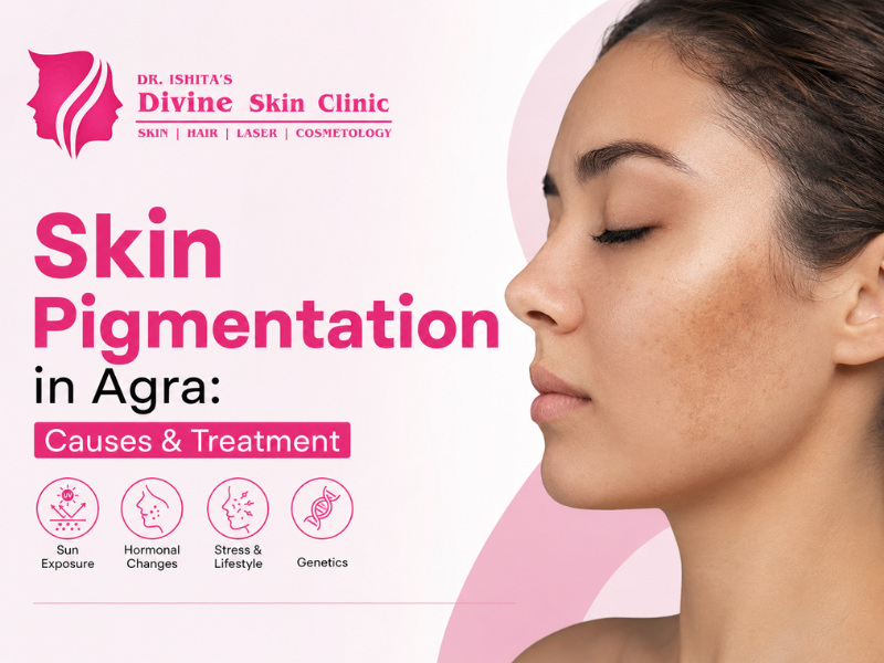 Skin Pigmentation in Agra – Dr. Ishita Raka Pandit at Divine Skin Clinic