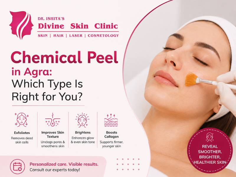 Chemical Peels for Skin Concerns: Which Type May Be Right for You?