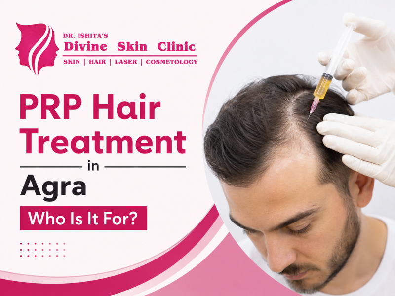 PRP Hair Treatment in Agra: Who Is It For and What Results Can You Expect?
