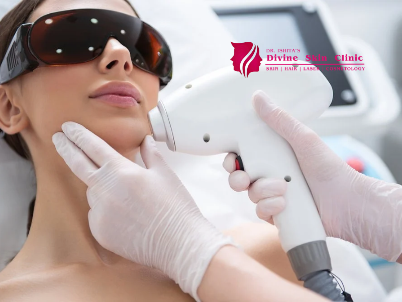 laser hair reduction in agra