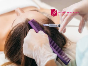 Hair Loss Treatment in Agra