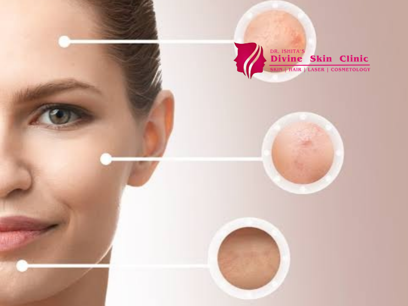 pigmentation treatment in agra