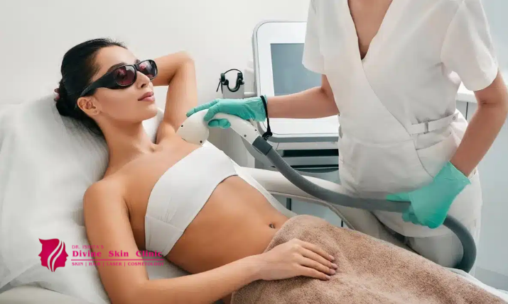 Laser hair removal treatment in Agra for long-term reduction of unwanted hair